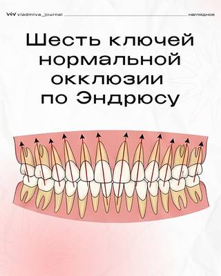Шесть ключей Эндрюса — основа идеальной окклюзии.